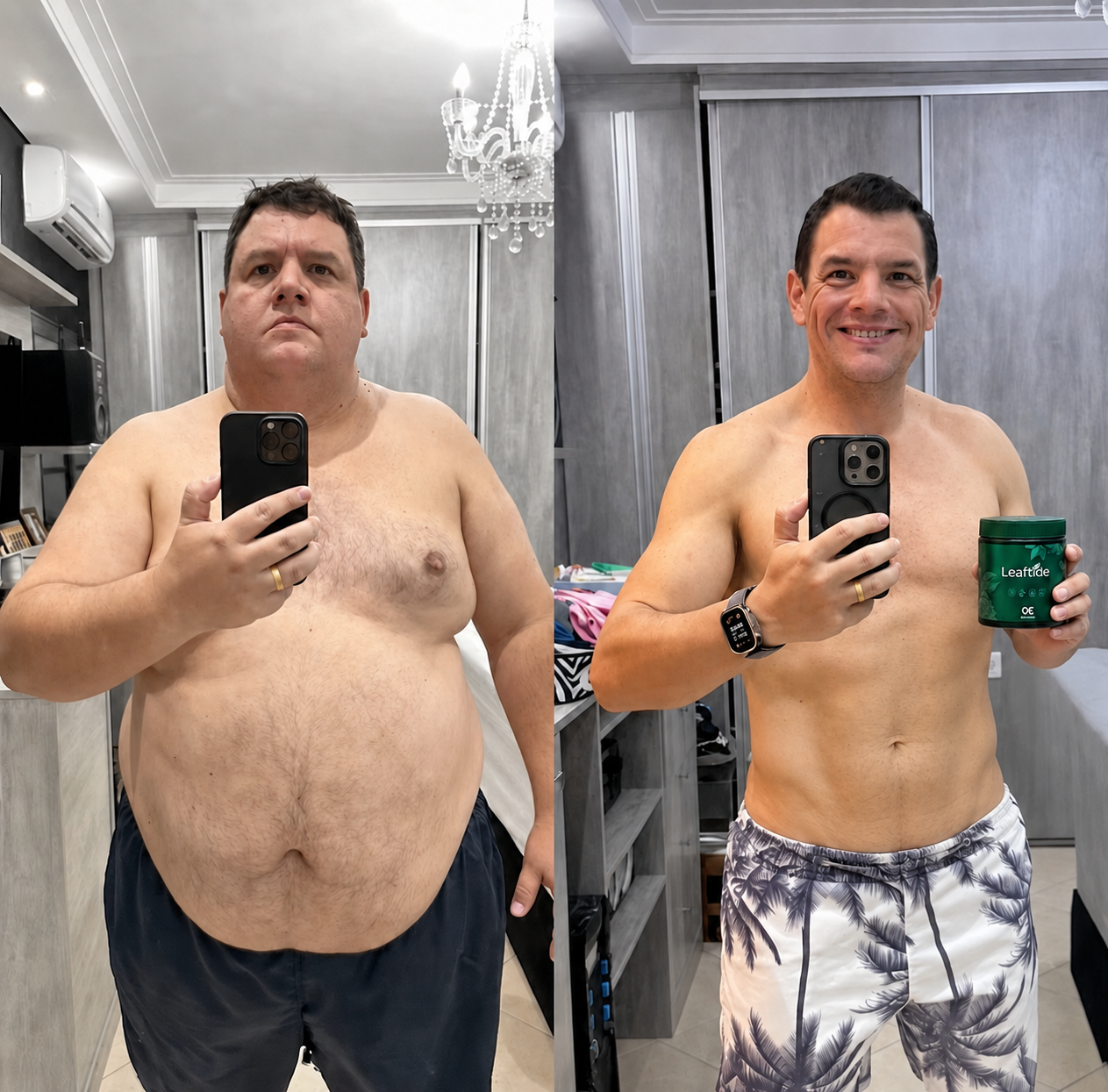 Michael J. before and after